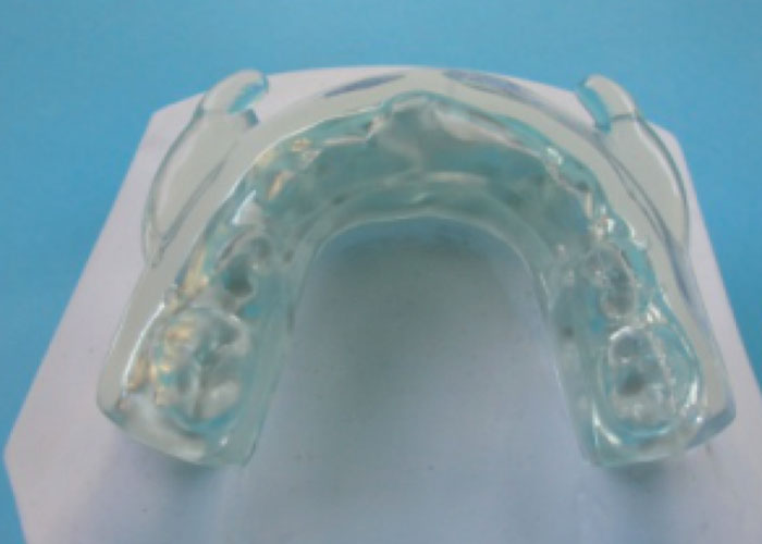 asiga-resources-dental-case-study-digital-dentistry