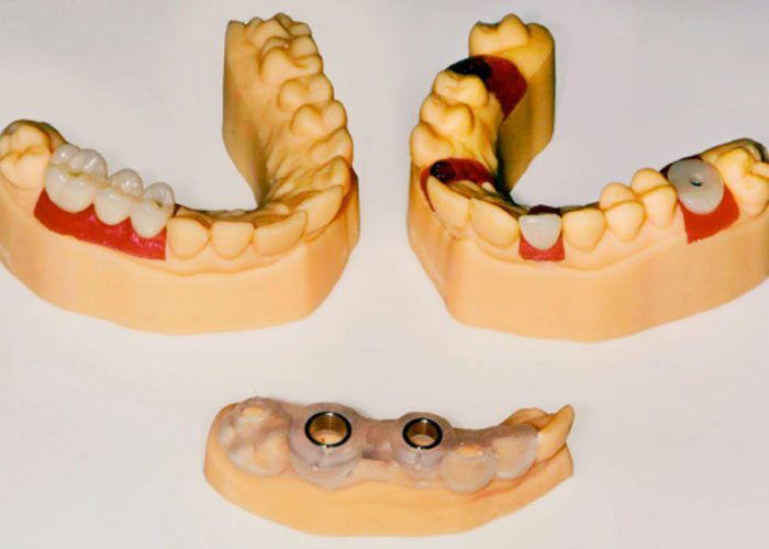 asiga-resources-dental-how-we-integrated-part-04