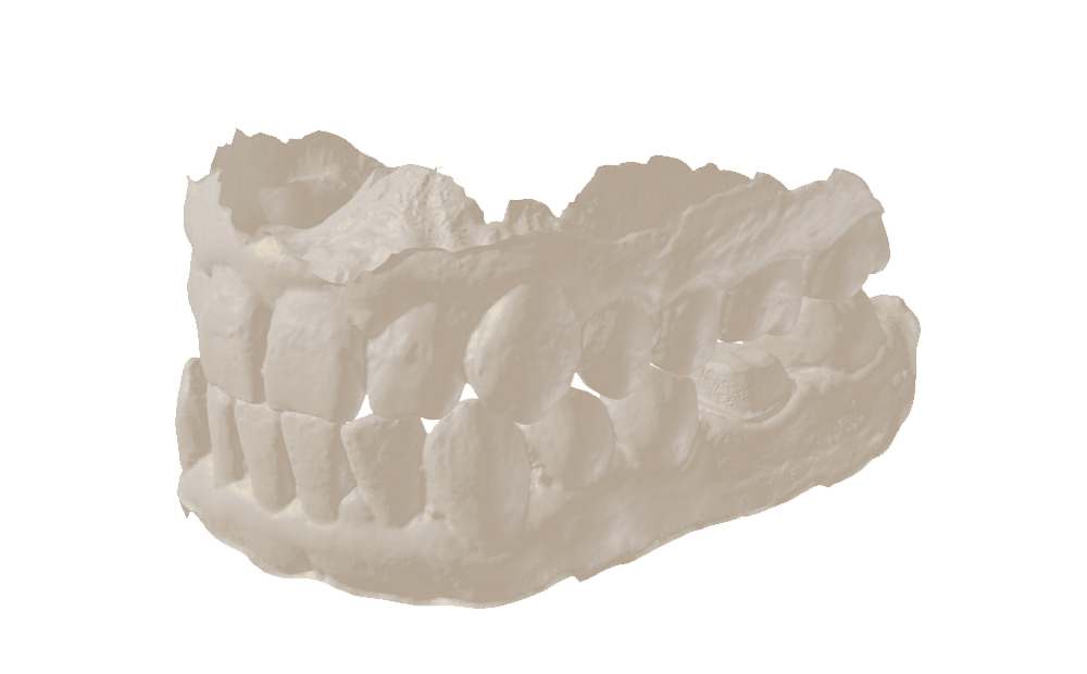 Standard material tray