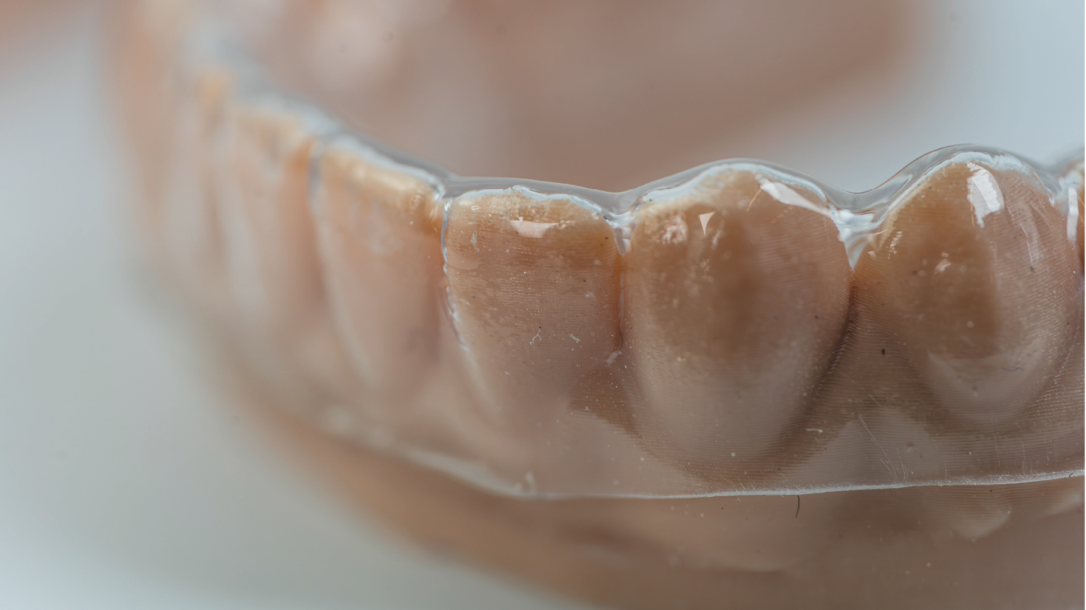 The end to sticky thermoforming with DentaFORM Beige. – Asiga
